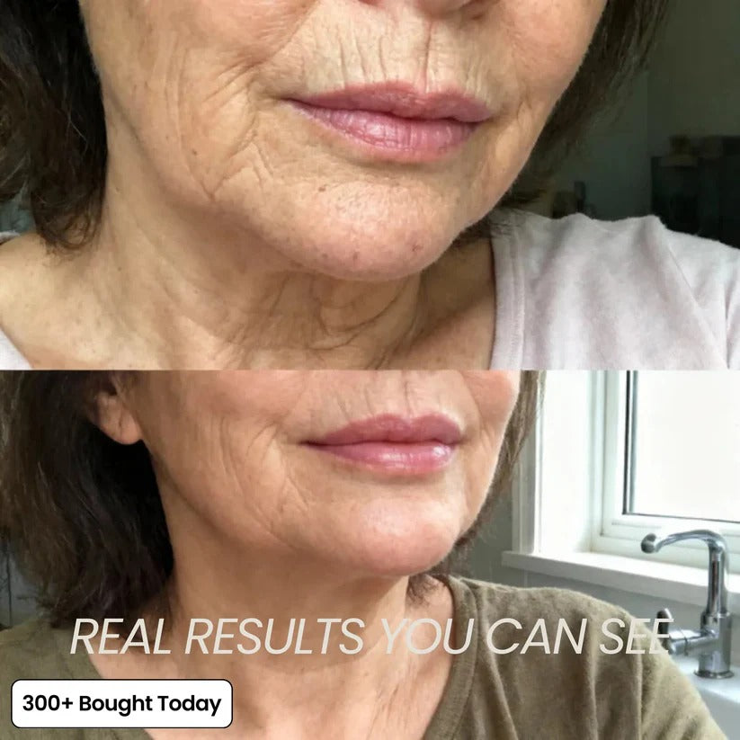 🔥LAST DAY 60% OFF Korean PDRN Pink Collagen Volume Multi Balm