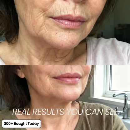 🔥LAST DAY 60% OFF Korean PDRN Pink Collagen Volume Multi Balm