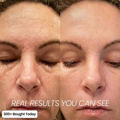 🔥LAST DAY 60% OFF Korean PDRN Pink Collagen Volume Multi Balm